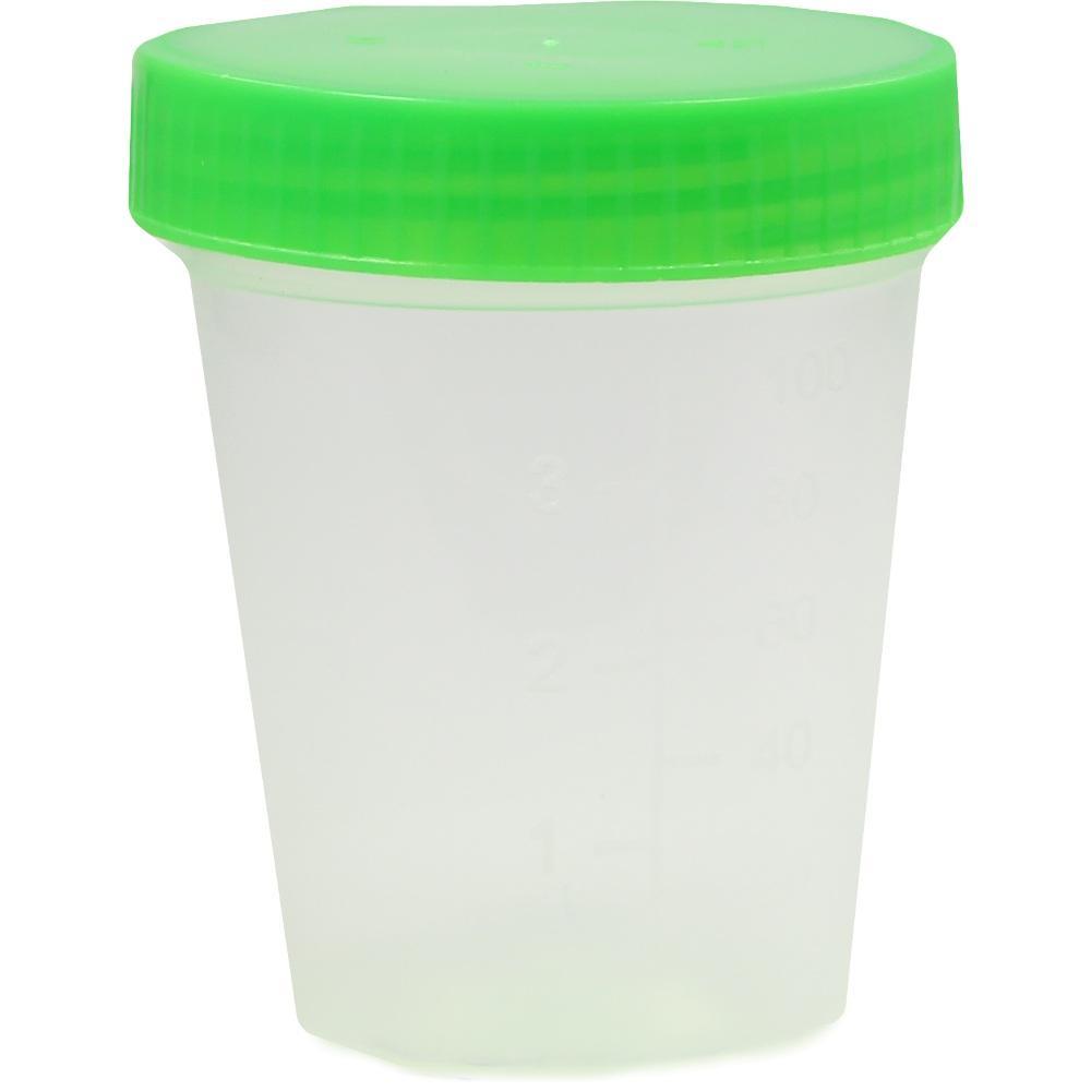 Ein durchsichtiger Becher mit gr&uuml;nem Deckel.